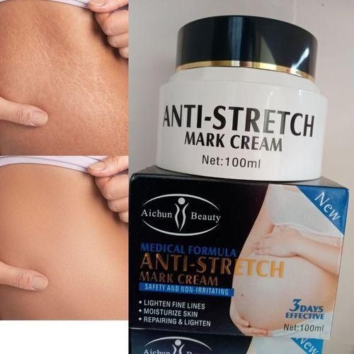 Aichun Beauty Anti Stretch Marks Cream