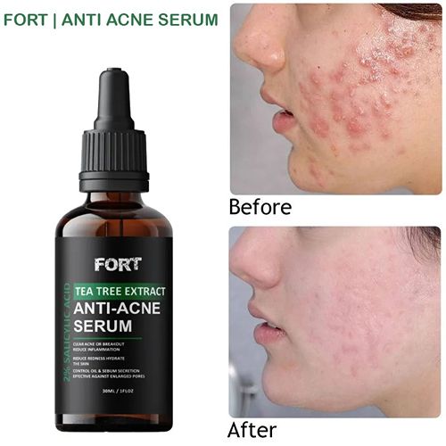 Fort 2 Salicylic Acid Tea Tree Extract Acne Serum 30Ml