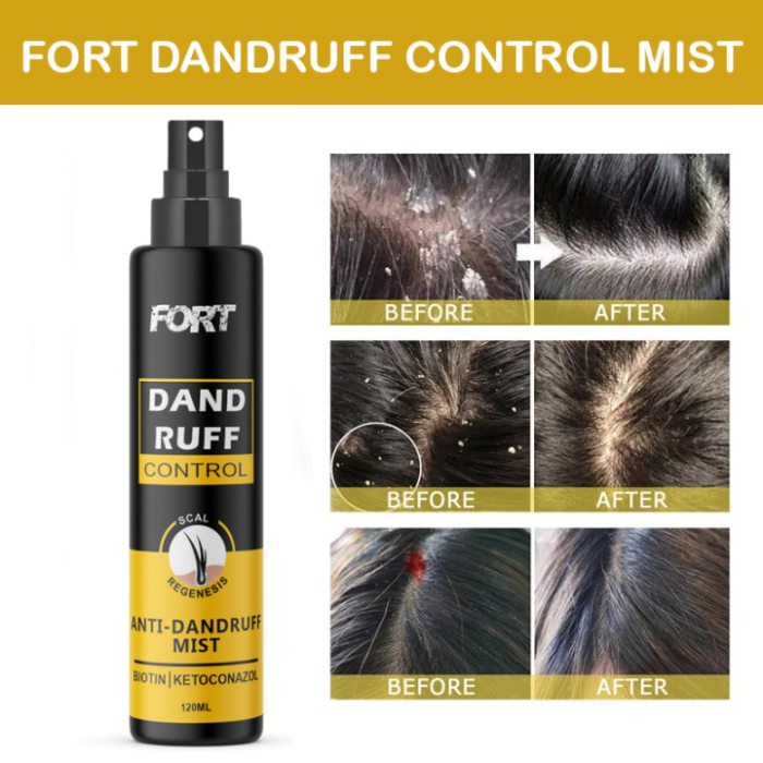 Fort Anti Dandruff Hair Mist