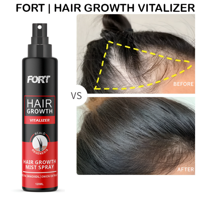 Fort Hair Growth Vitalizer Spray