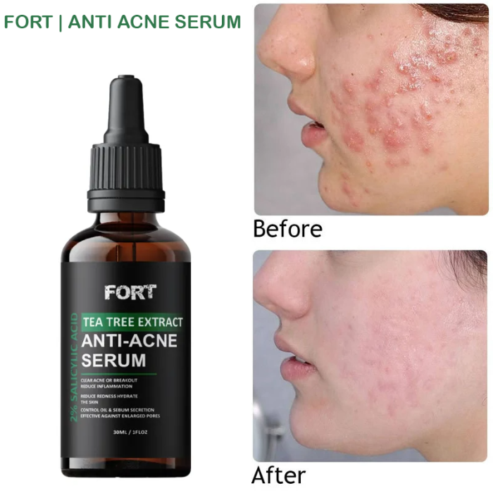 Fort Salicylic Acid Serum