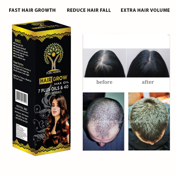 Hair Grow Max Hair Oil