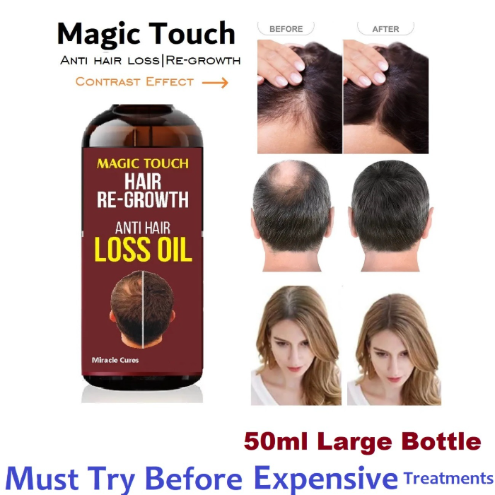 Magic Touch Anti Hair Loss Hair Regrowth Oil