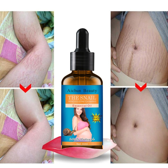 Natural Snail Extract Stretch Marks Oil