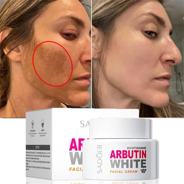 Sadoer Nicotinamide Arbutin White Facial Cream