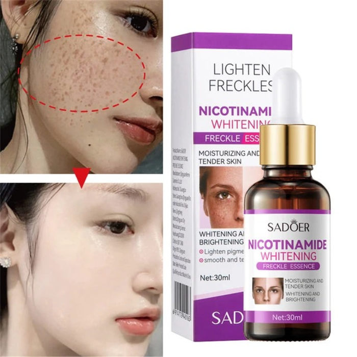 Sadoer Nicotinamide Whitening Freckles Serum