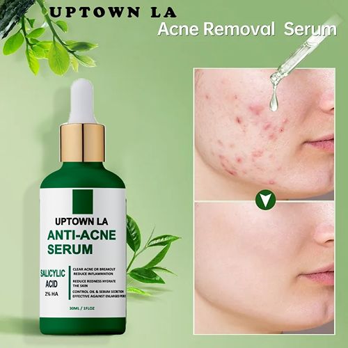 Uptown La Anti Acne Serum